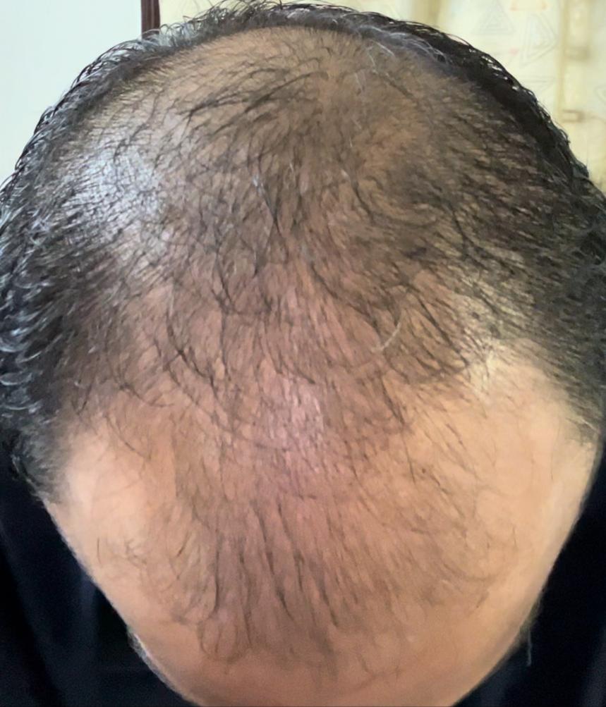 Before